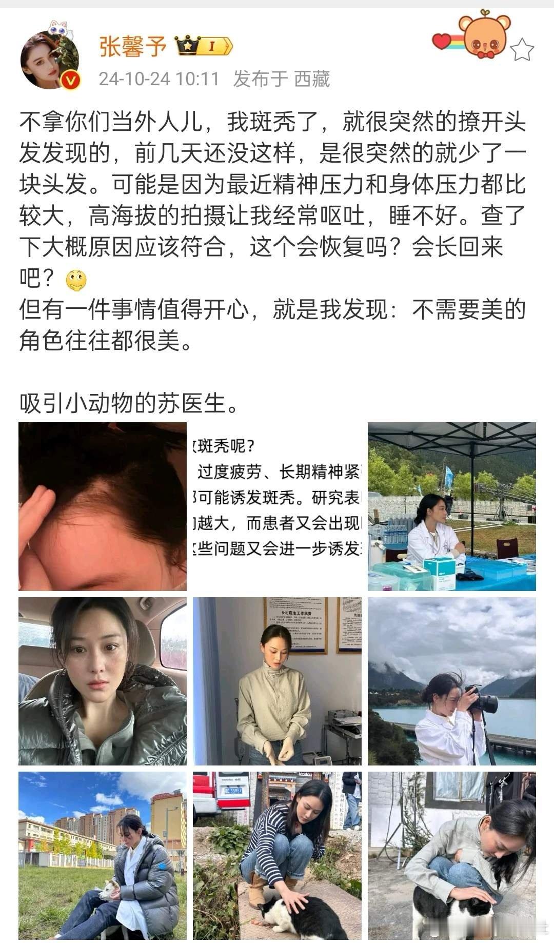 #张馨予自曝患斑秃#张馨予发文说自己斑秃了，姐姐不要给自己太大压力，明星也是普通