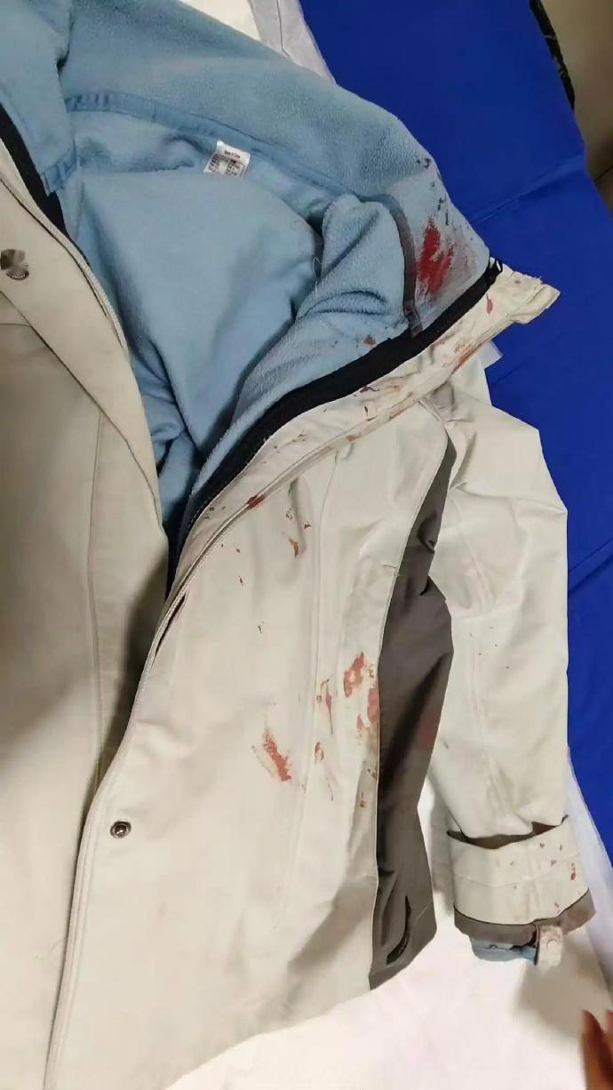 【女警徒手夺刀制止行凶面部缝30余针】河南女民警徒手夺刀成功制止行凶 1月5日，