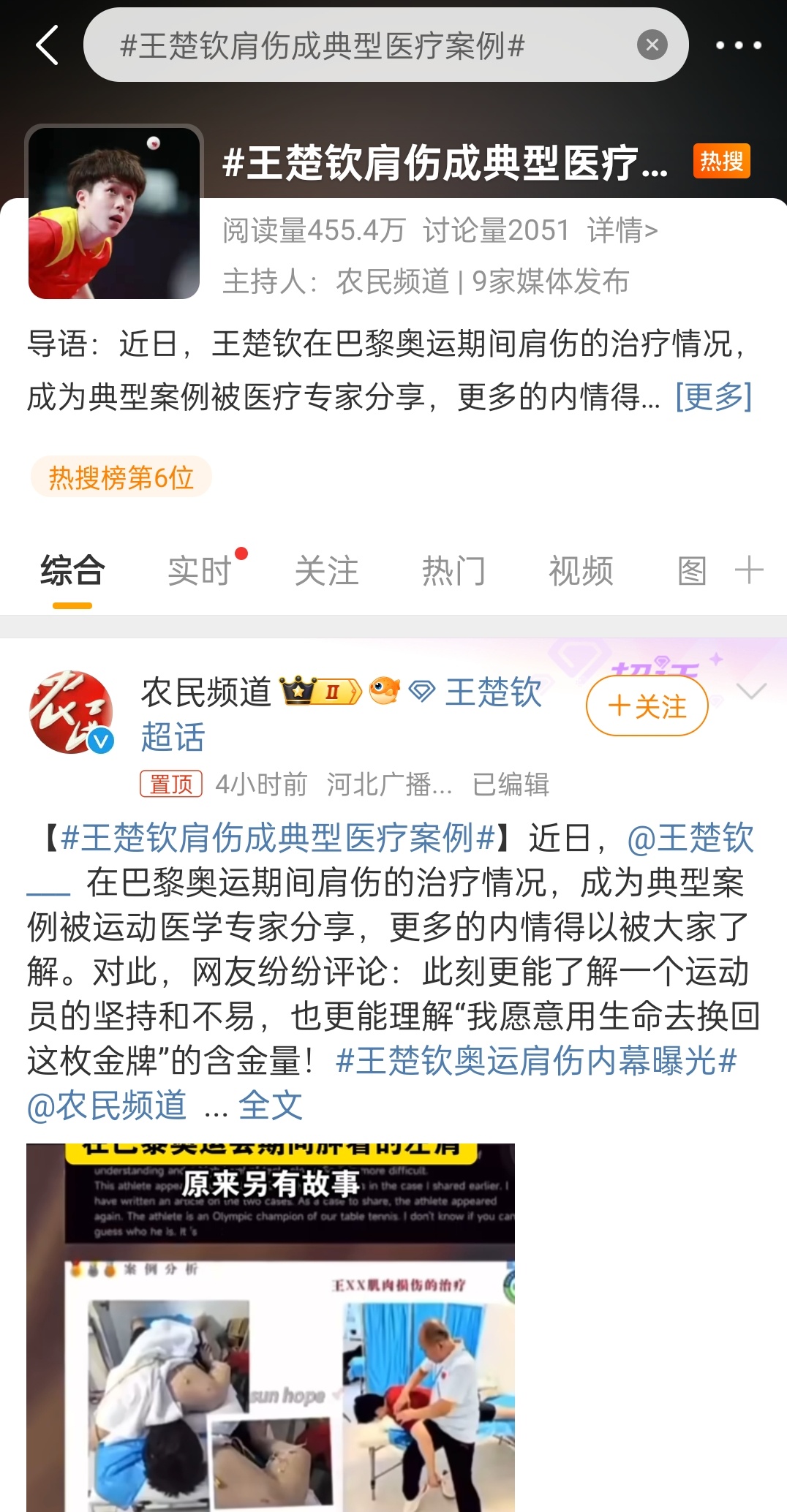 什么意思，这是提前挽尊还是洗白巴奥…… ​​​
