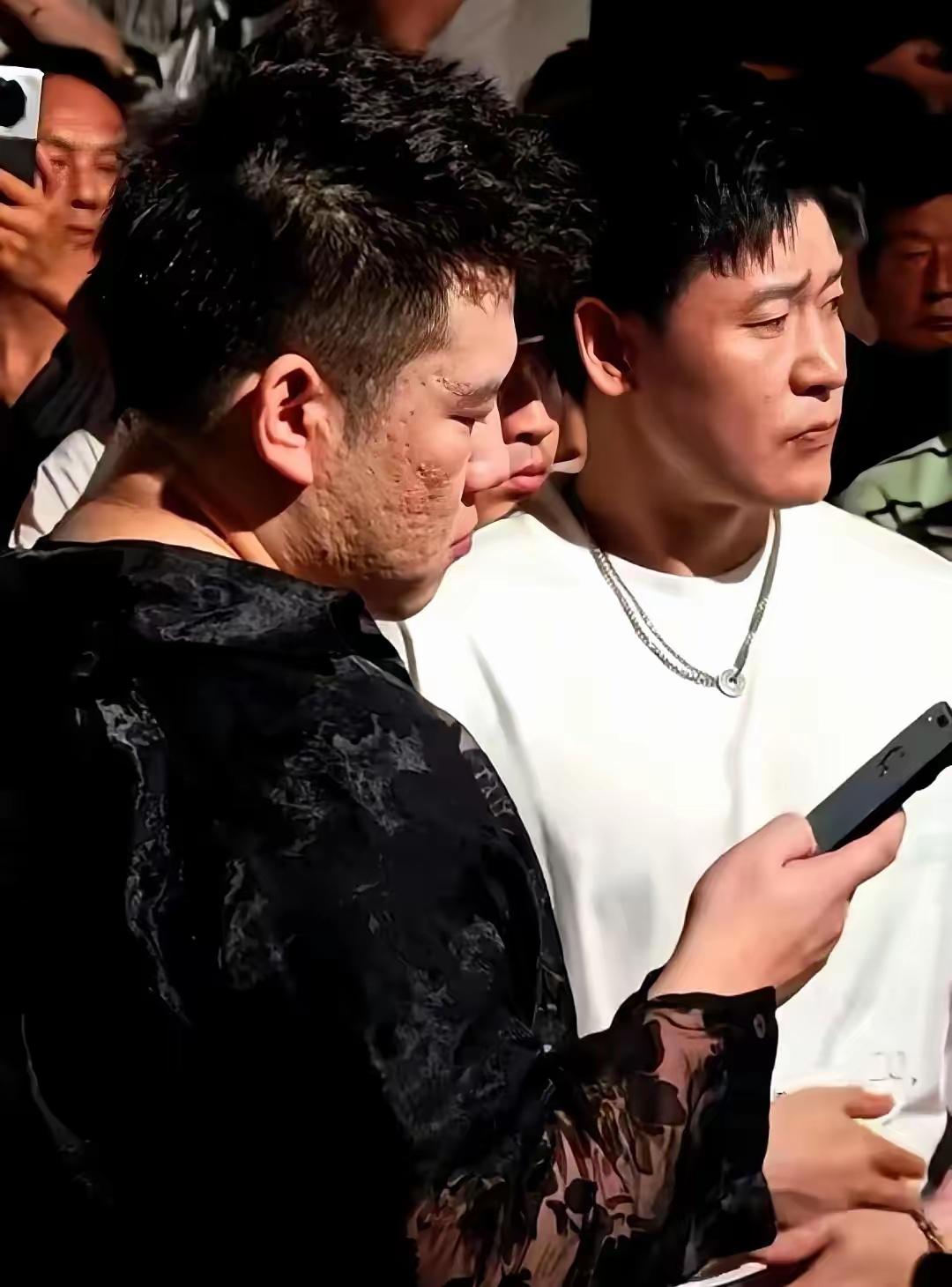 为啥人脸会那么坑坑洼洼的，这到底是啥原因造成的？有了解的朋友帮忙解释下。