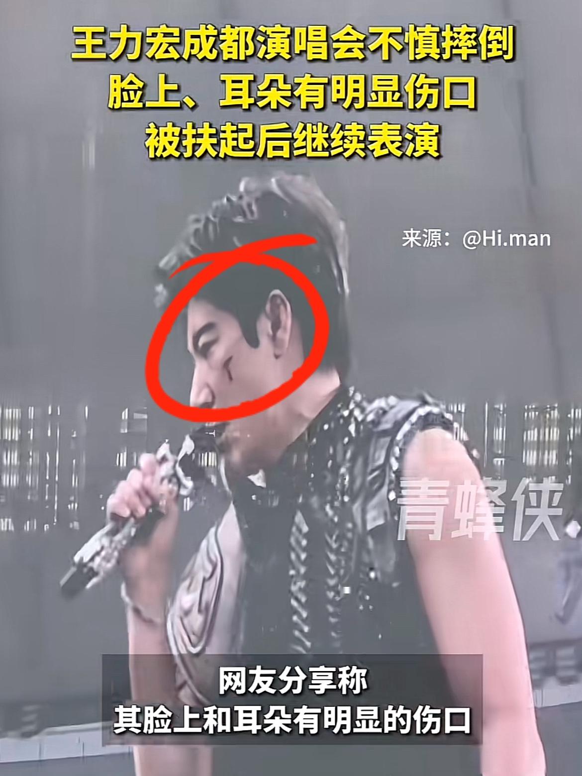 有个问题，一直想问，
舞台安全管理到底谁在负责？
王力宏成都演唱会上，被一根被遗