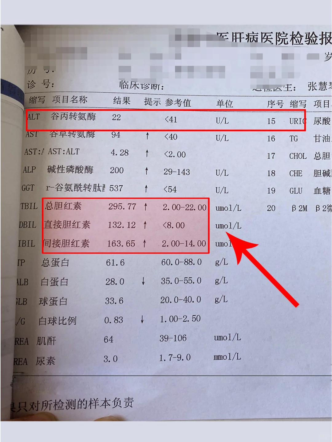 转氨酶高不可怕，这一指标更危险小心肝衰竭