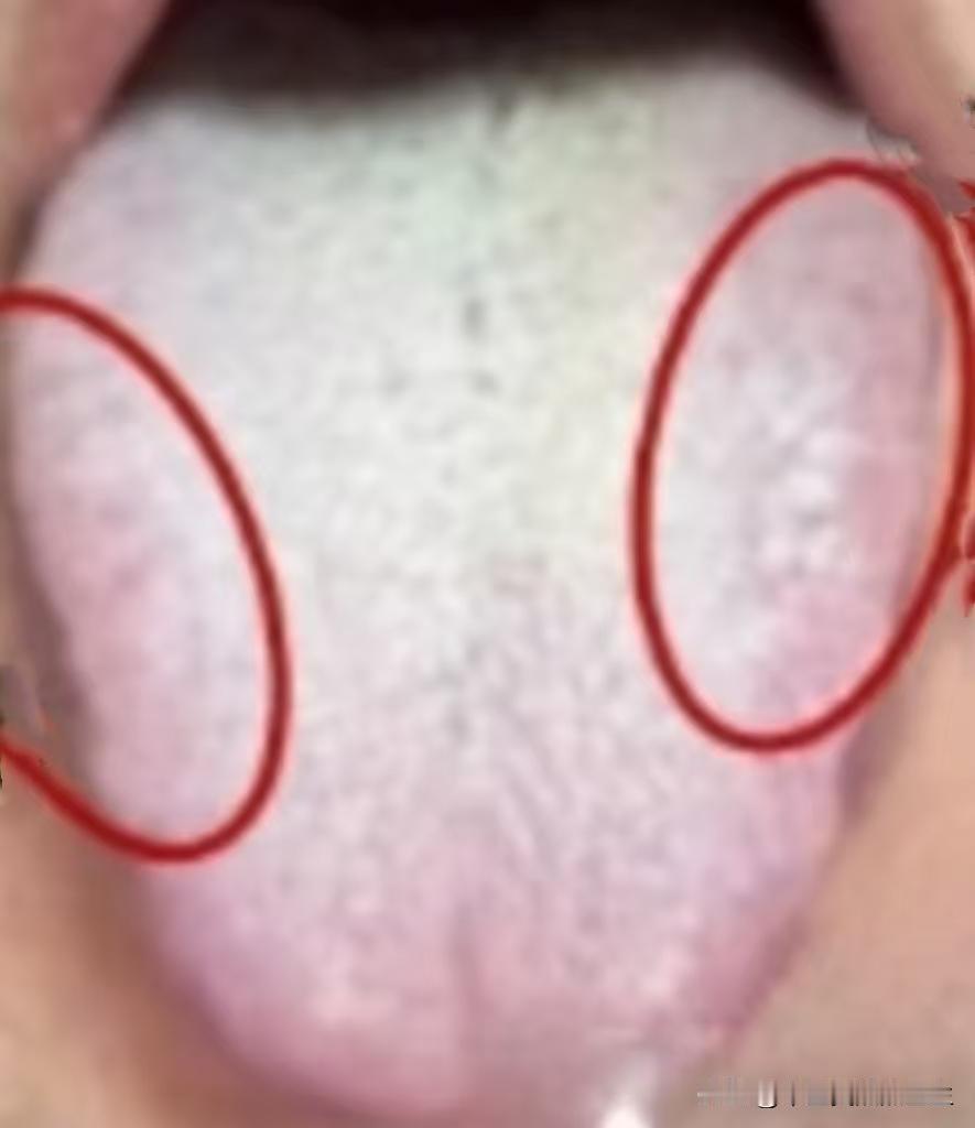 这种舌象，问题不是一般的多，只温阳恐怕是不行！

患者主诉：房事不行，续航差，阴