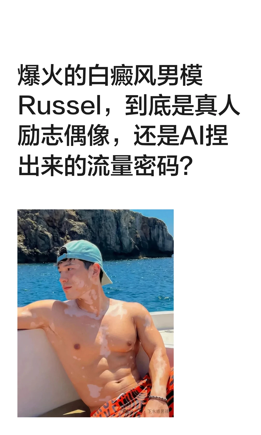 爆火的白癜风男模Russel