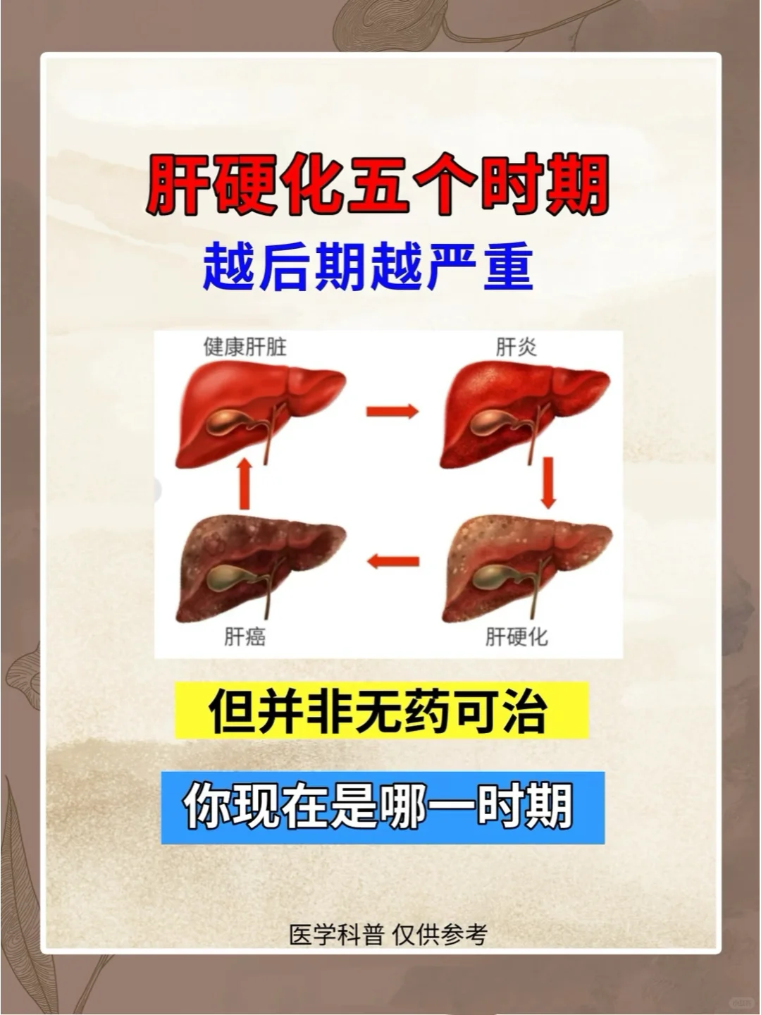 肝硬化的五个时期，你知道吗？发现了千万别再拖 