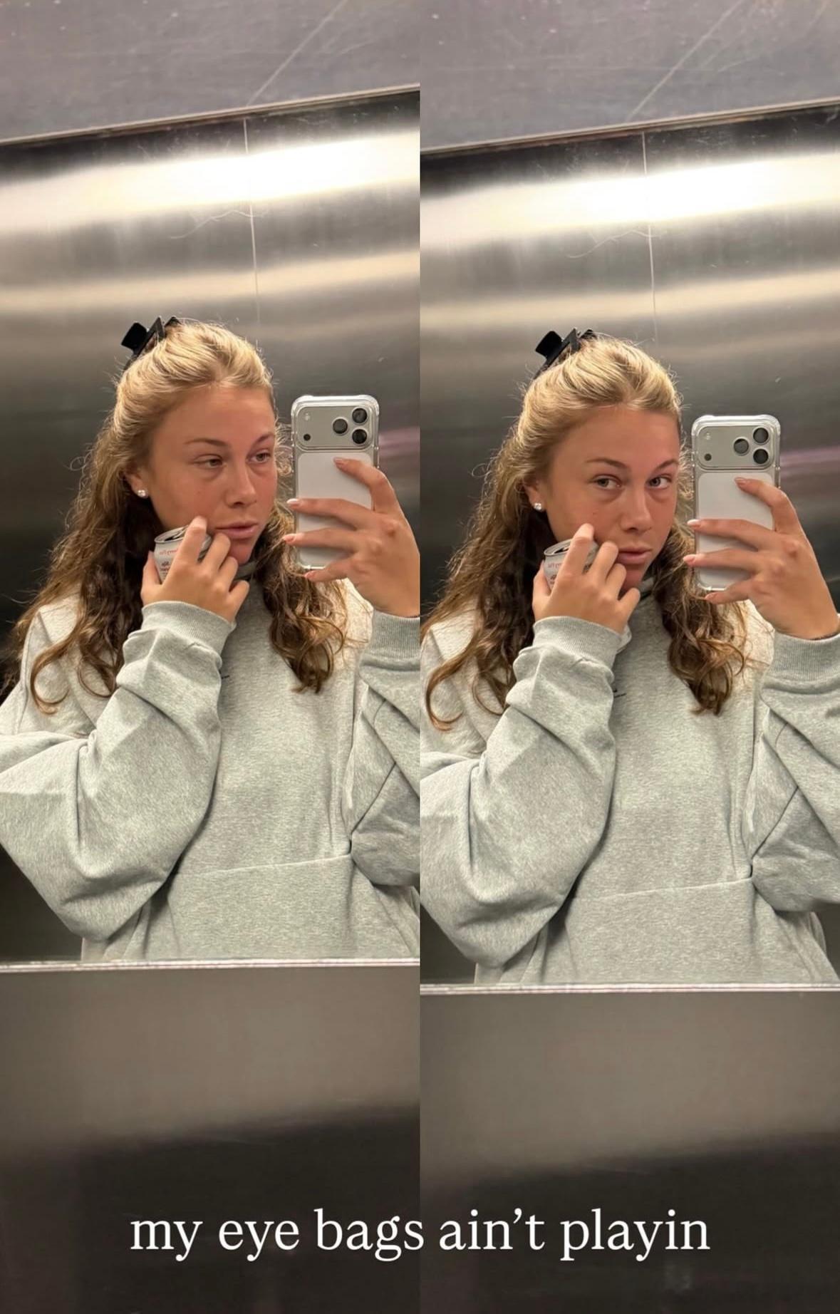 阿尼西莫娃吐槽自己的眼袋👀今年夏天8月份Amanda就发过eye bagswt