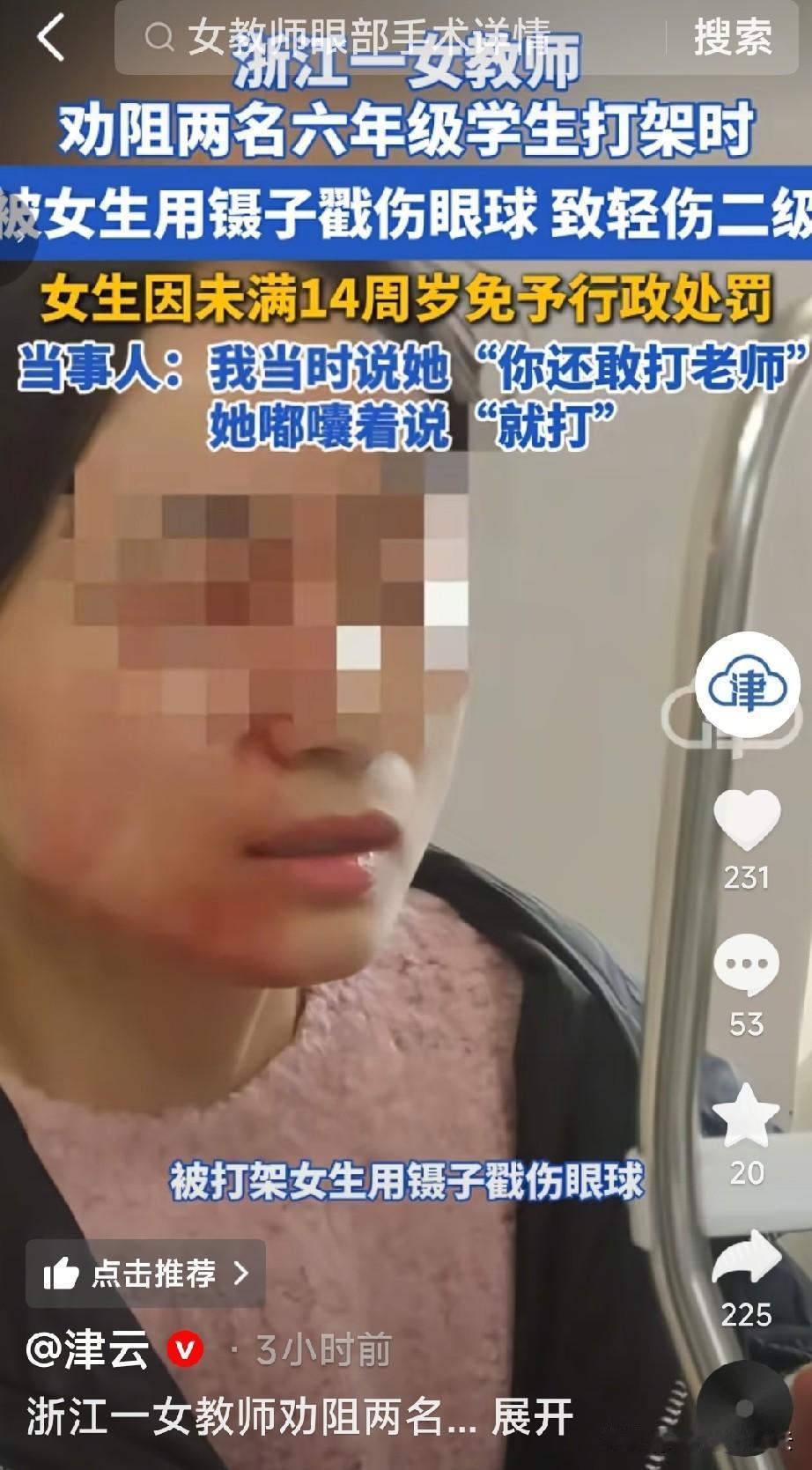 太让人心痛了。浙江42岁的女老师因为给学生劝架，竟然让一个女生拿镊子戳伤了右眼，