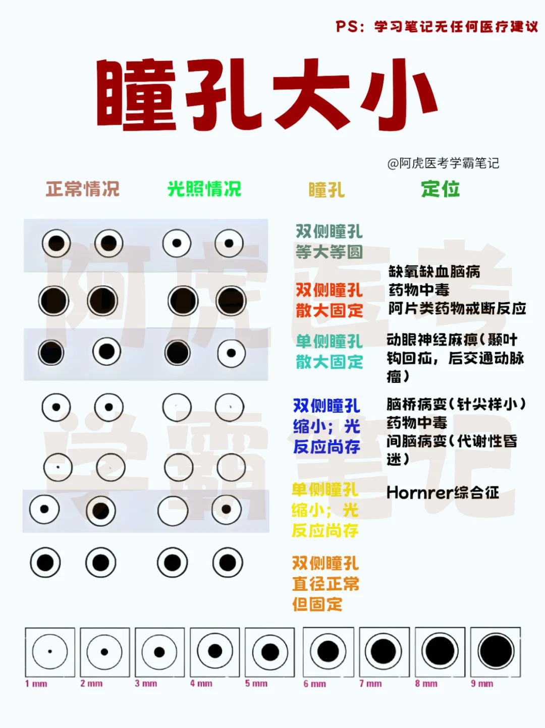 医学生笔记📒：不同瞳孔直径👆