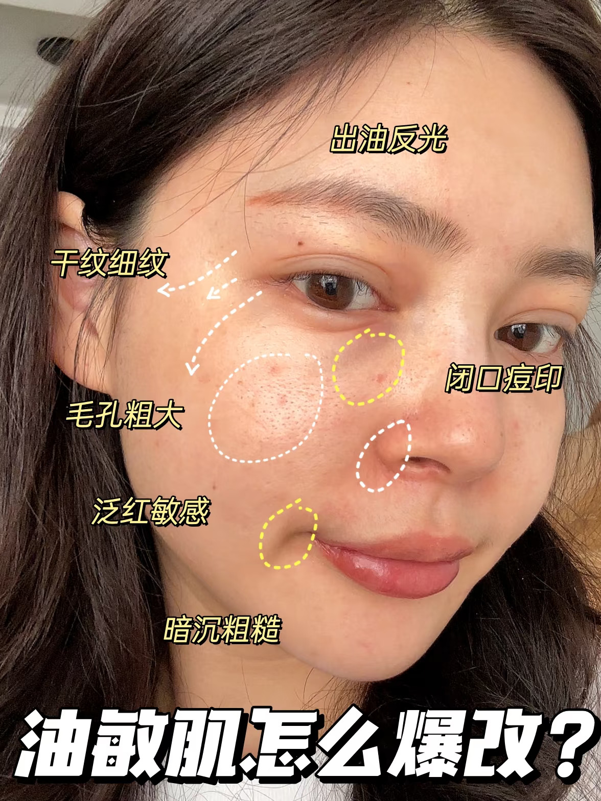 不是吧？油皮敏感问题就这么解决了？