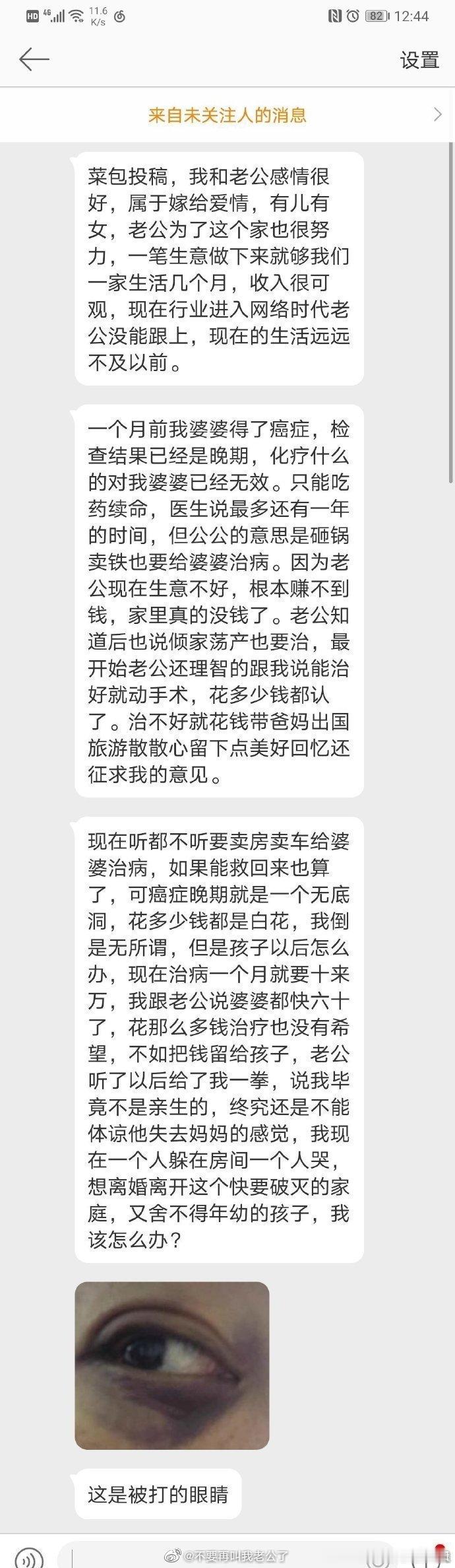 我婆婆快60岁了，癌症晚期 ​​​