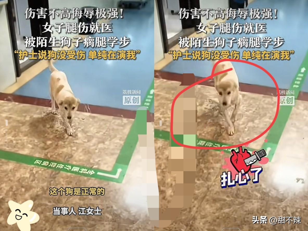 “真成精了？”重庆一女子腿受伤去医院，正一瘸一拐忍着疼挪步，冷不丁瞅见只狗狗也跟