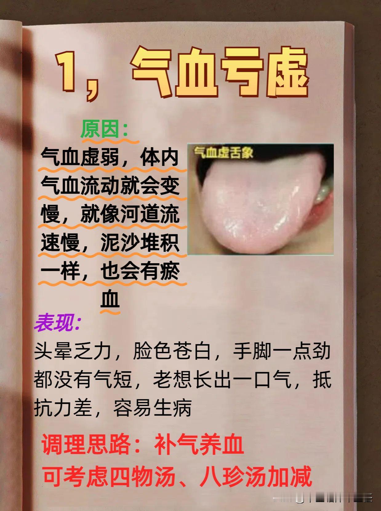 中医揭秘血瘀的4个原因，教你巧妙应对！