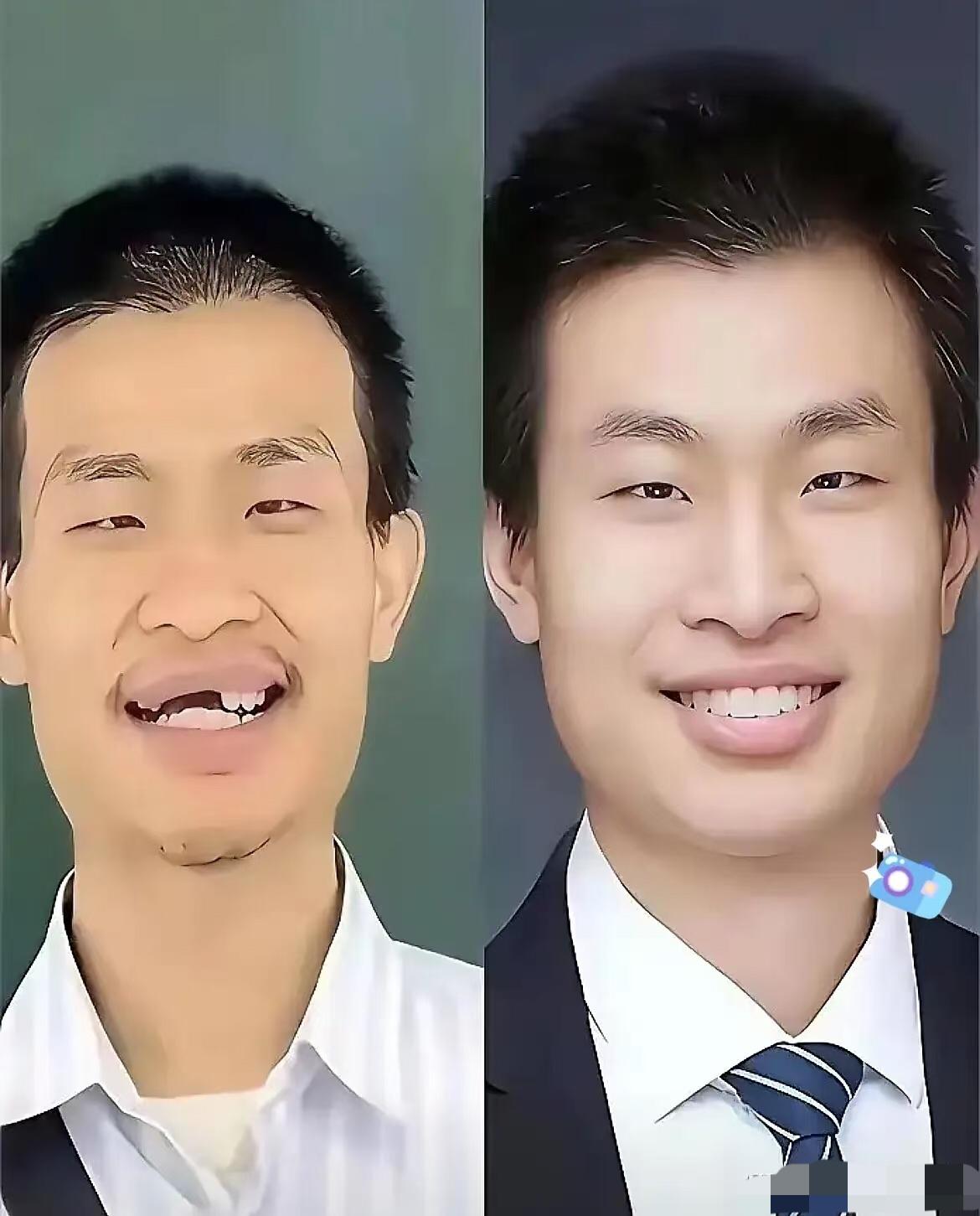 韦东奕被反超！！！

北大韦神，三十多了，在北大刚刚评上副教授，到目前为止，还没