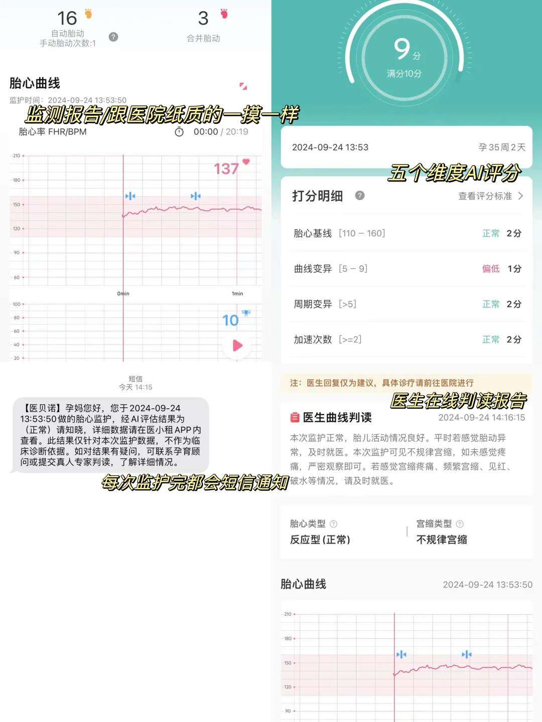 孕35W｜为了老公，我跟风租了胎心监护仪