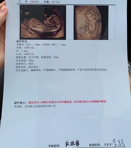 我怀上啦~听说好孕会传染哟~下一个就是你