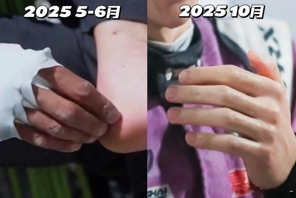 这就是王一博作为冷白皮的恢复能力吗