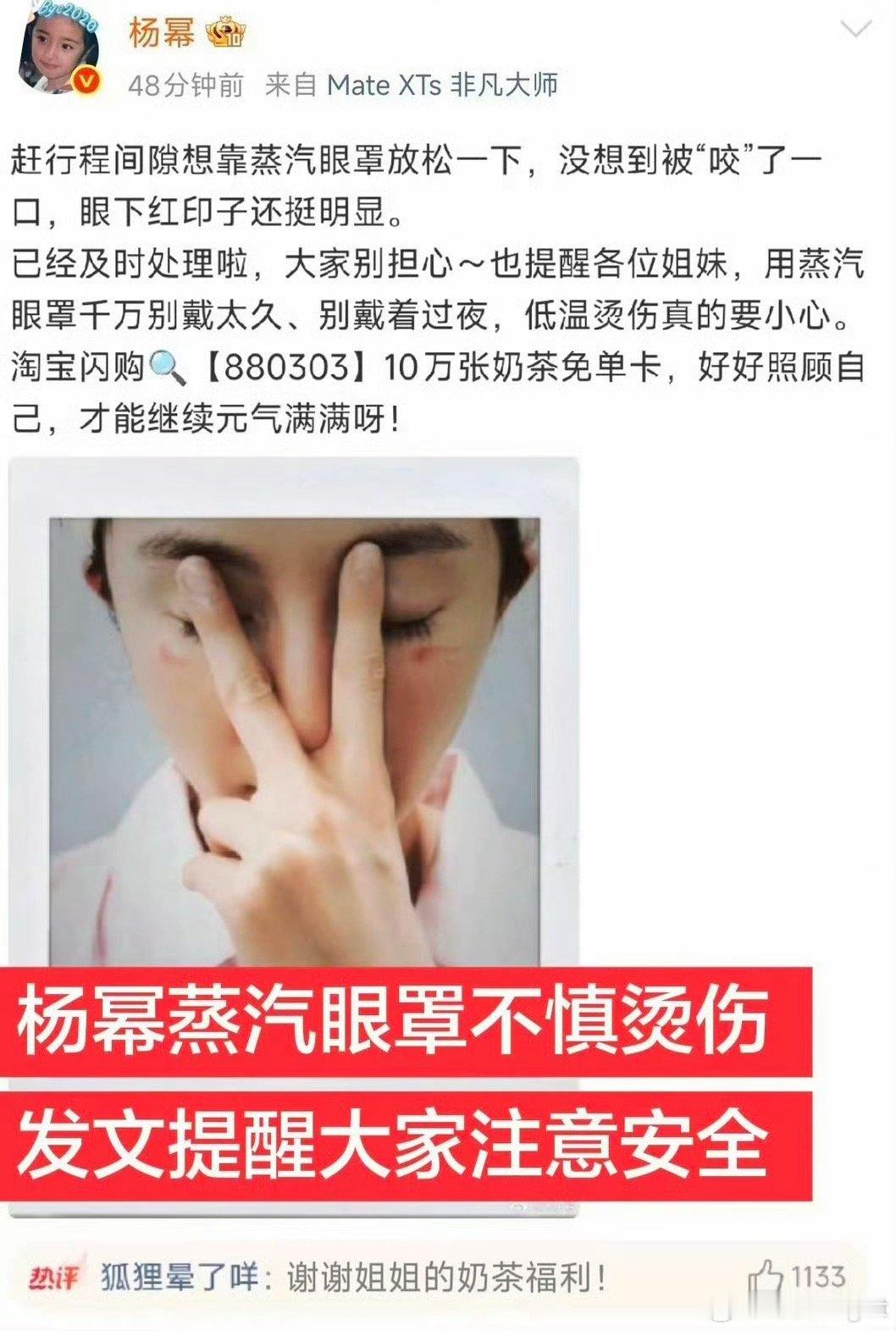 啊这，我一般坐飞机还挺喜欢用蒸汽眼罩的杨幂脸被蒸汽眼罩烫伤了