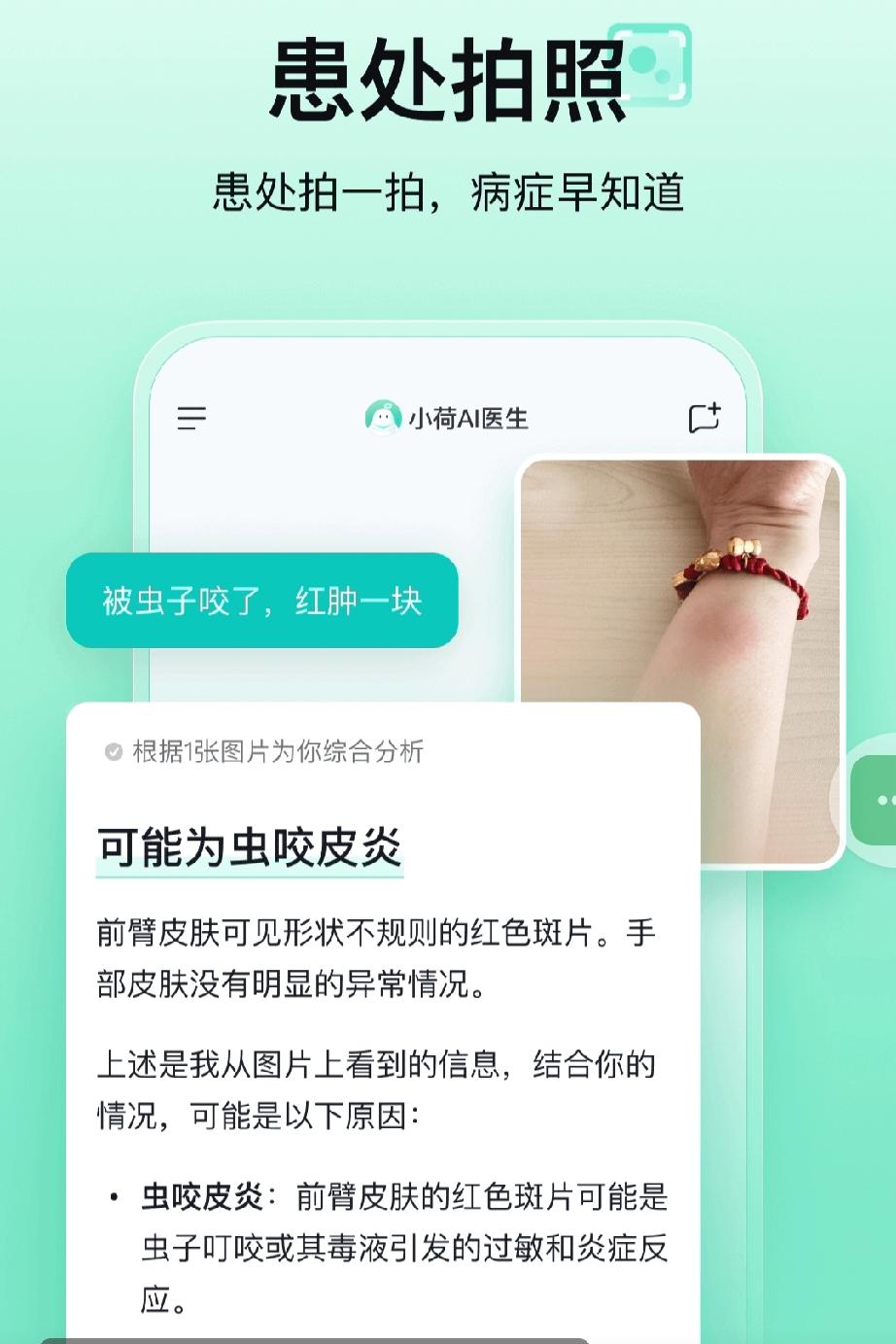 医疗AI的靠谱底色：藏在“会思考”里的技术真章
 
当小荷AI医生能像临床医师般