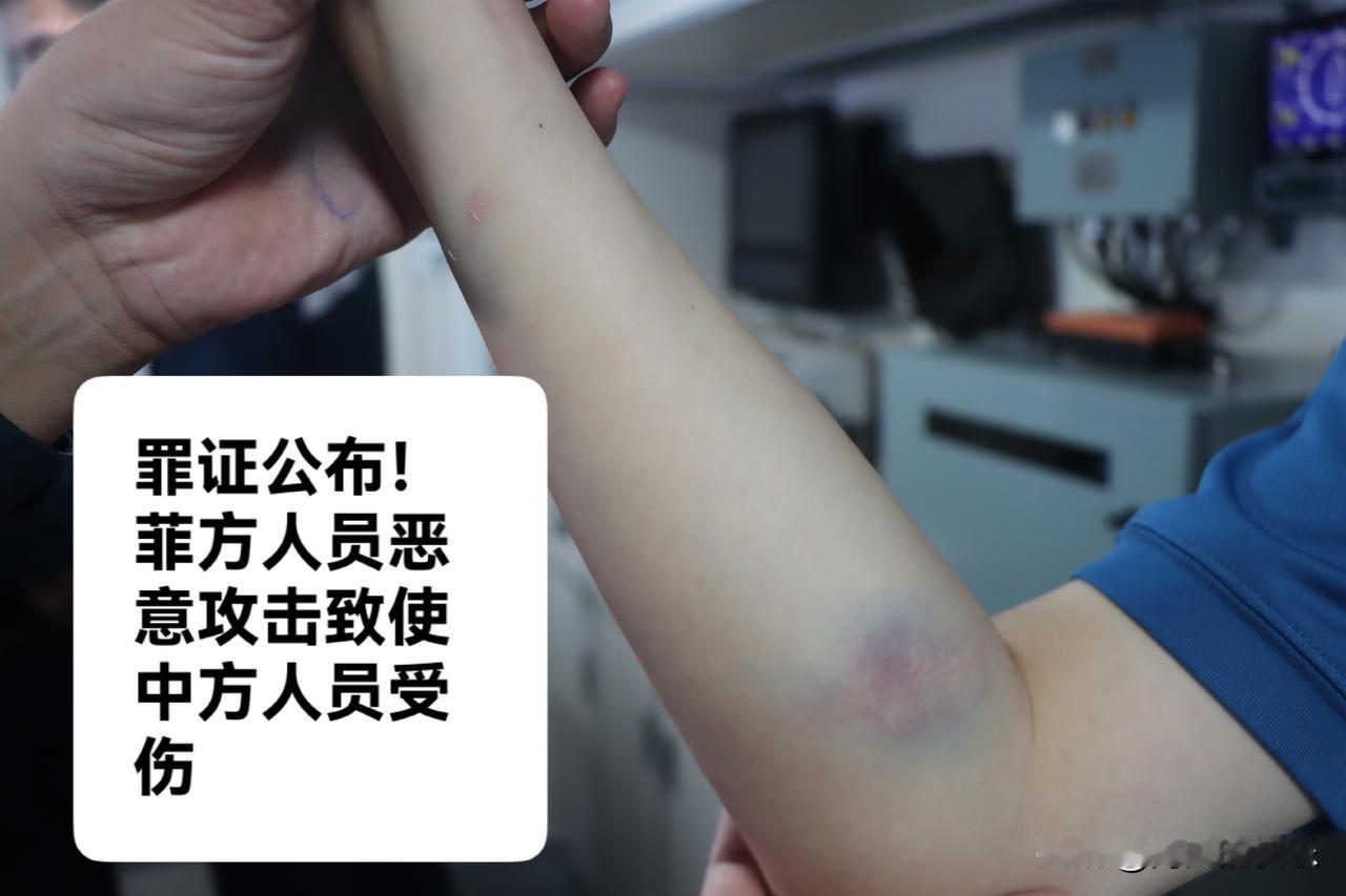 罪证公布！菲方人员恶意攻击致使中方人员受伤

   据媒体报道7月20日上午9时