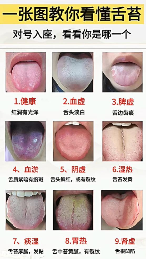 舌头有齿痕、紫斑？对照 9 种舌苔看看体质