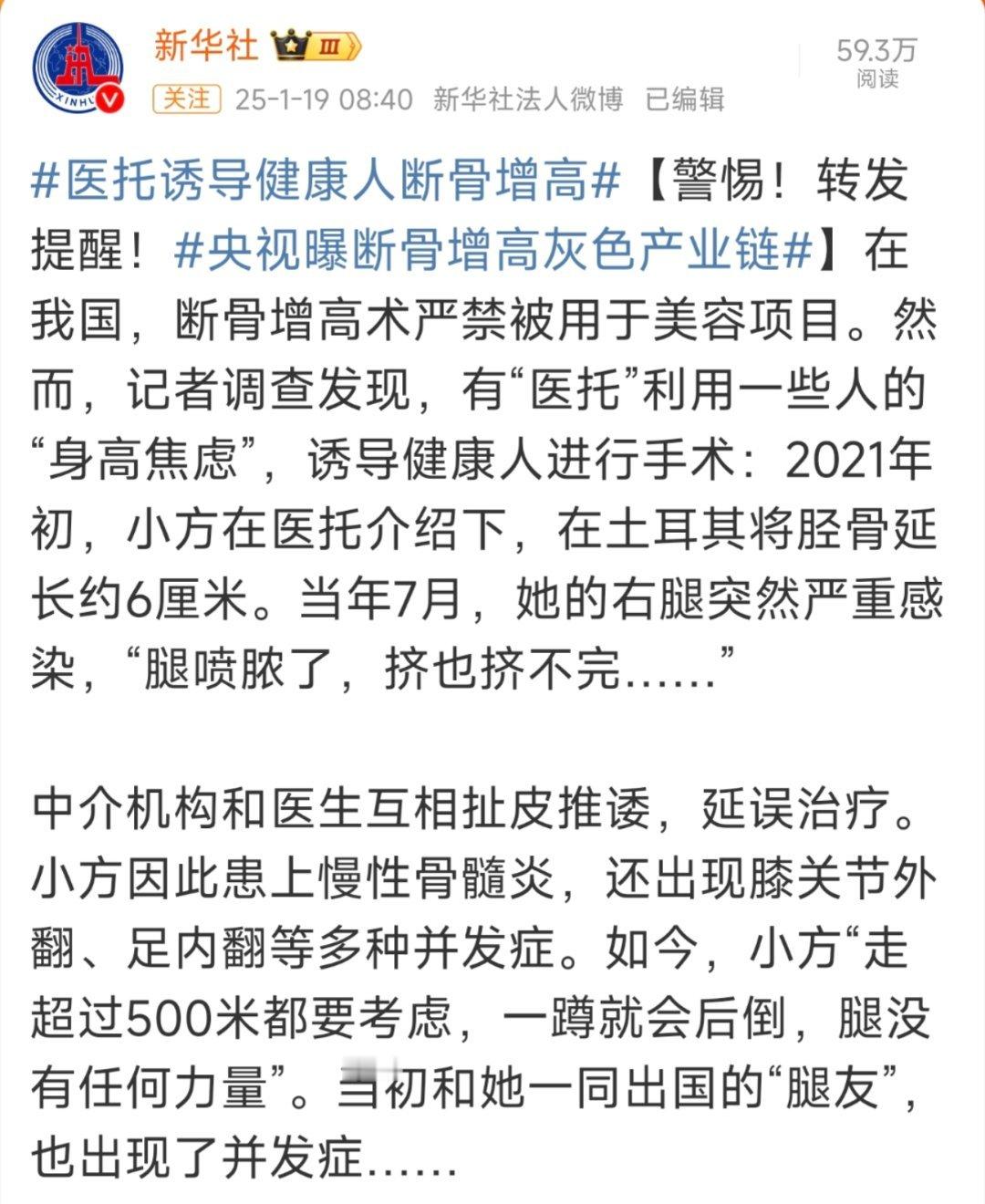 正常腿被医生伪装成畸形做断骨增高 断骨增高？听名字都开始疼了，国内不允许做绝对是