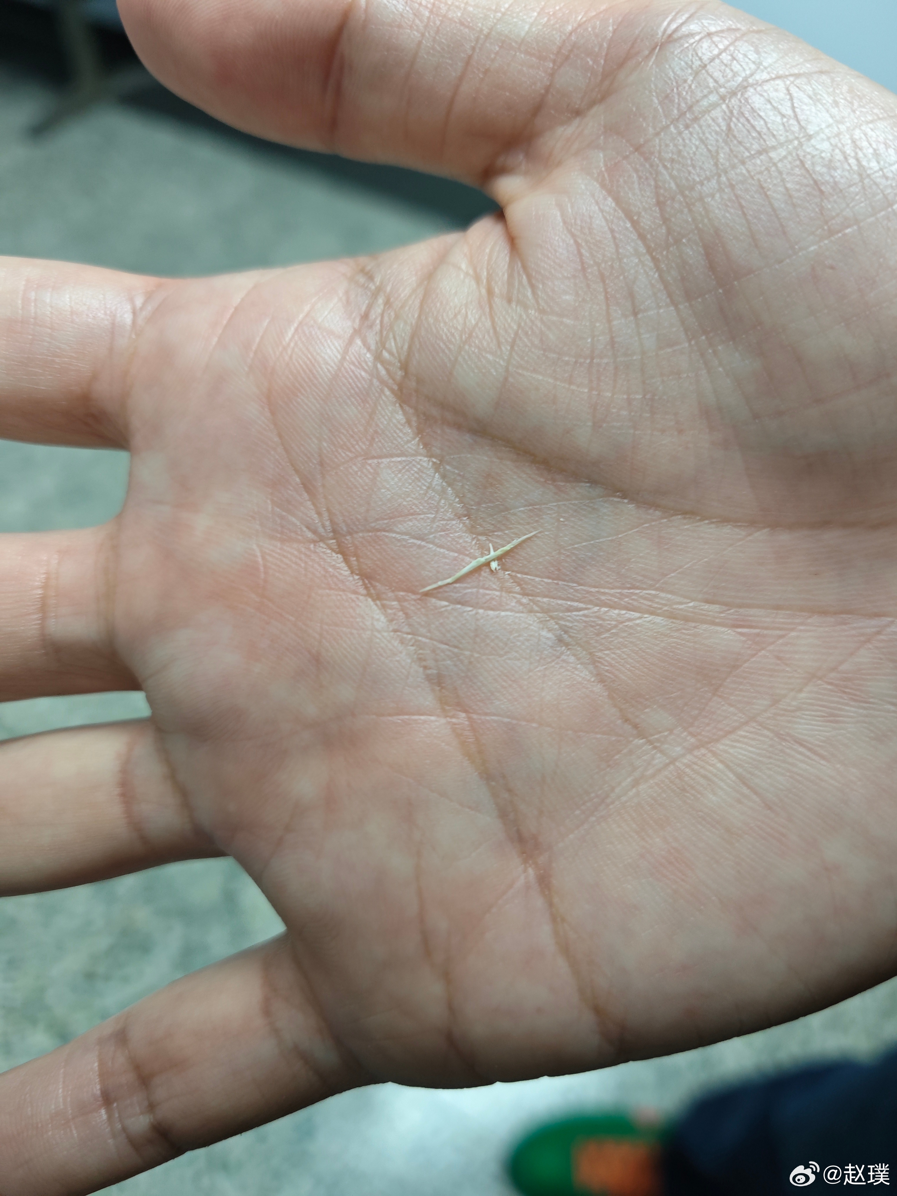 卧槽，这么长一根鱼刺在嗓子里扎了好几天，我说咋一直觉得嗓子有点不舒服呢。。。 ​