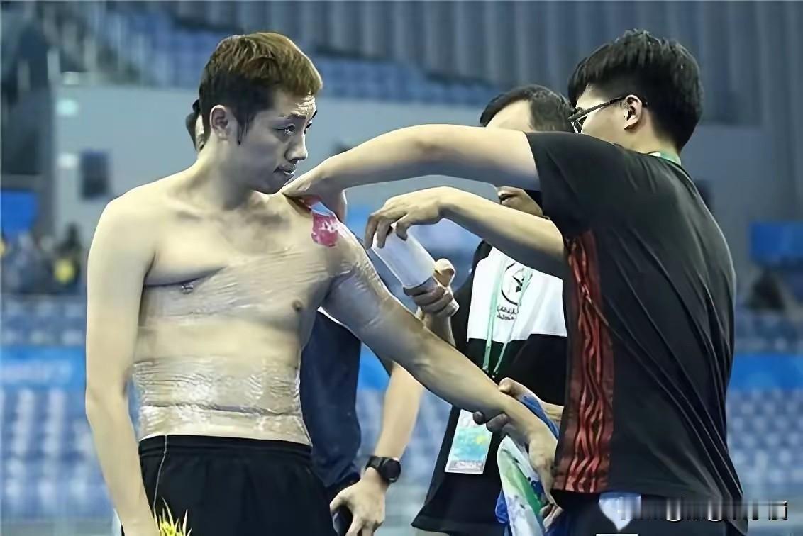 许昕在直播中说，只要国家队有需要，他二话不说就回去，撒腿就跑。他虽然退役了，自己