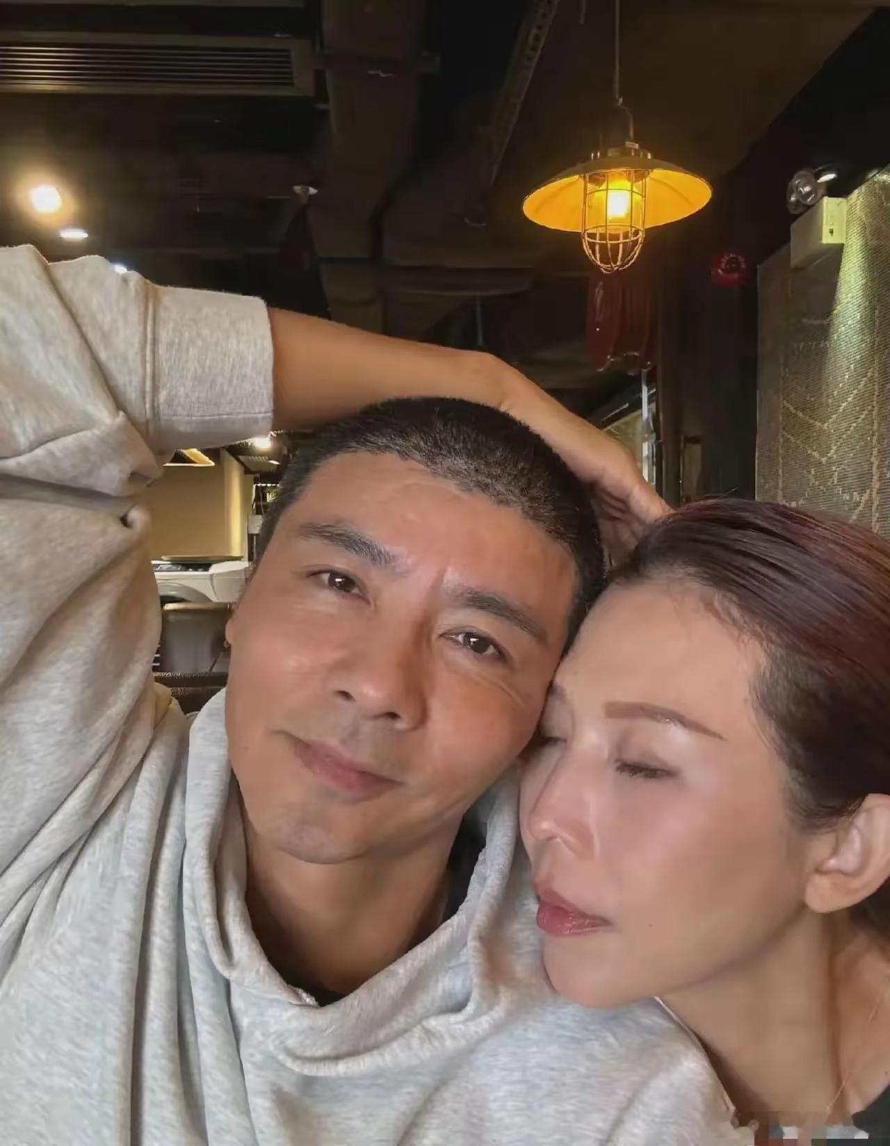 张晋找的植发机构的审美不太行，发际线植的太低了，还很不自然 ​​​