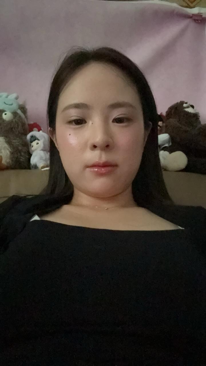 姐妹们 刚拍完视频做完onda和钛提升好像脸真的瘦了点双下巴都不明显了 