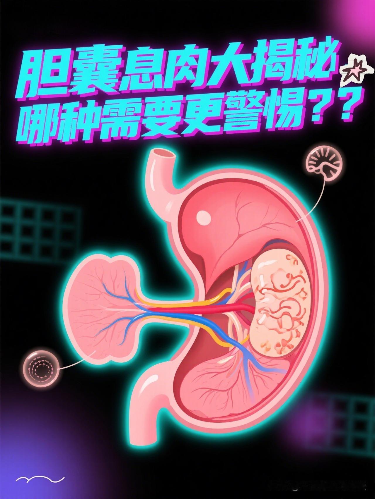 胆囊息肉大揭秘，哪种需要更警惕？？？
–
随着腹部超声检查的普及，越来越多的人在