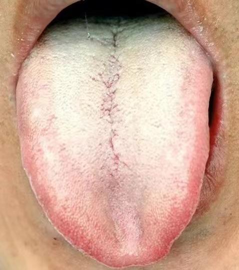 在面对这类患者时，就会很无奈，本身问题不算大，但就是很难给他们调理。

一开始在