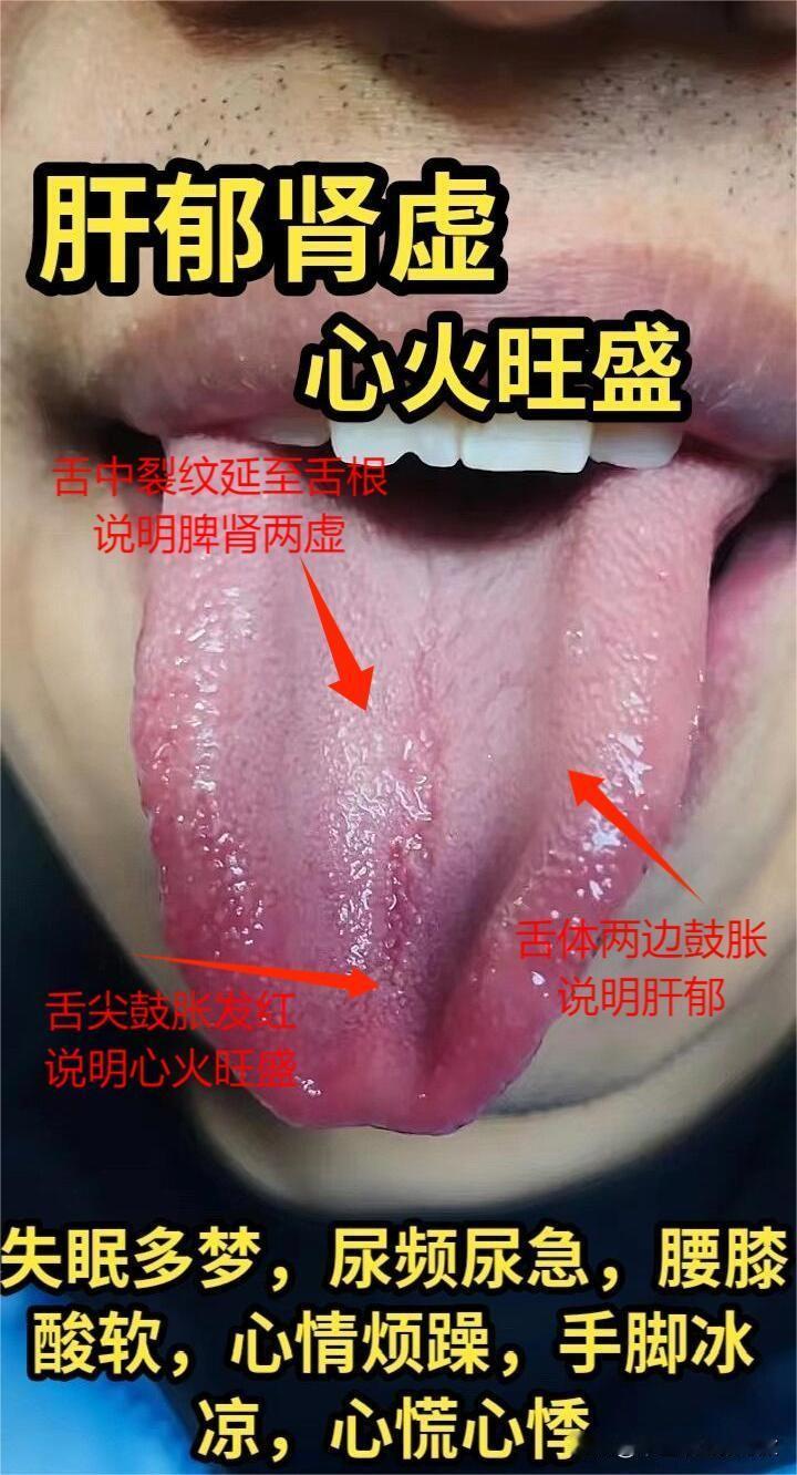 腰膝酸软，整天犯困，房事又快又无力[what]
门诊3种典型肾虚舌象，一次让你全