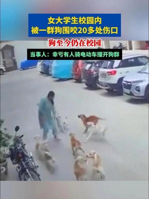 揪心！平顶山学院女生遭流浪狗群咬伤20多处，暖心男生挺身相救
 
4月21日上午