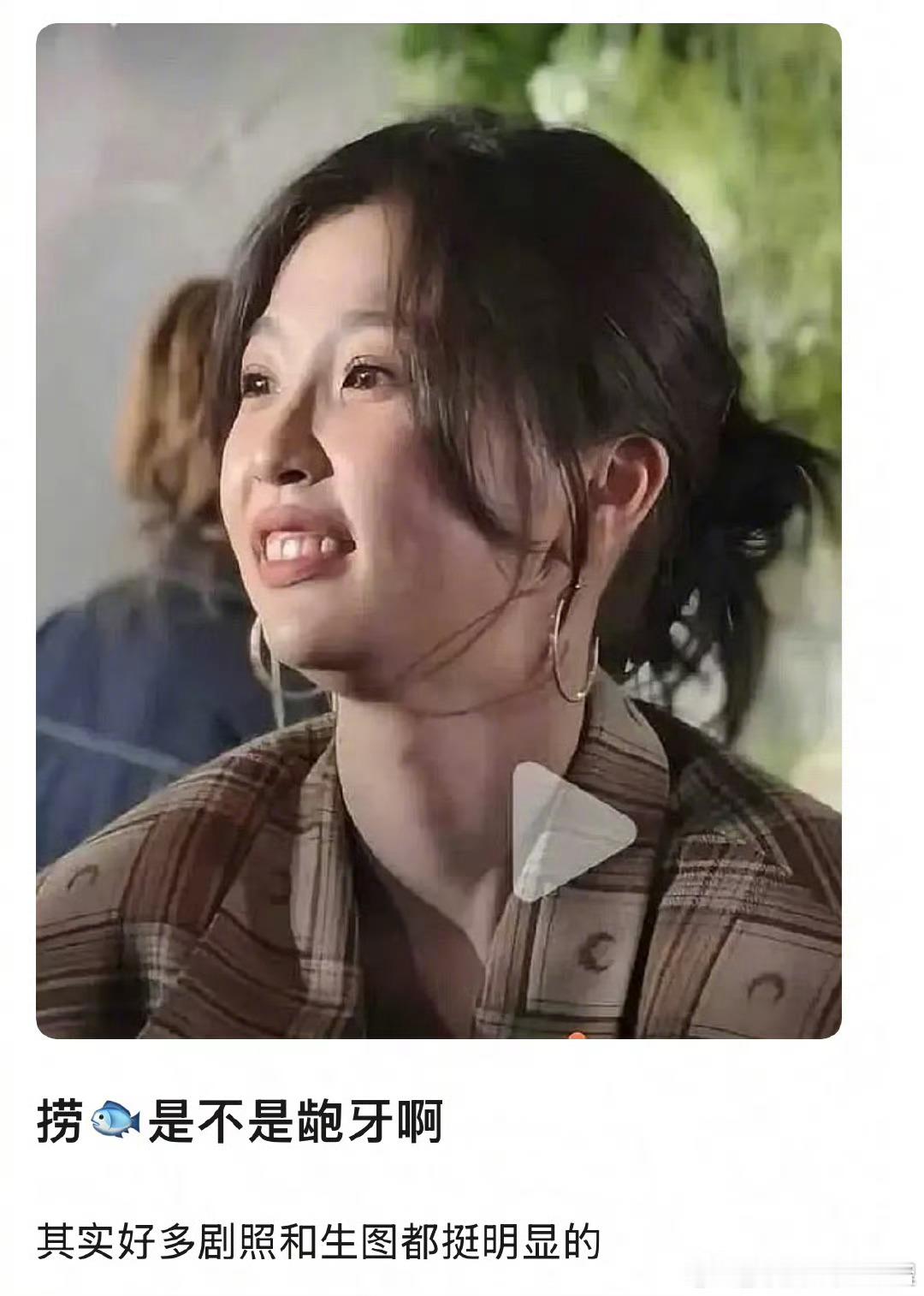 虞书欣的龅牙是颜值的硬伤吗 ​​​