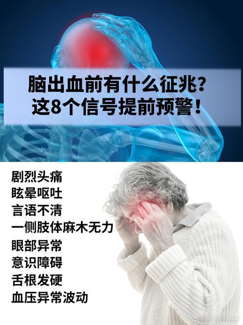 脑出血头痛会让人突然惊叫头痛还带"音效"？脑出血可不是普通脑壳疼，它是颅内"爆水
