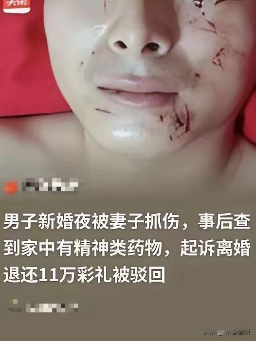 四川达州，男子新婚，想和妻子圆房，结果被新娘抓得满脸花，说自己在生理期。等了几天