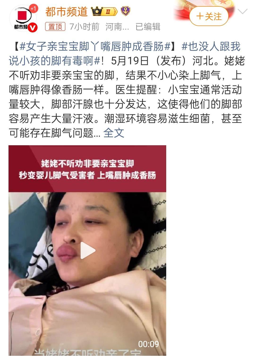 女子亲宝宝脚丫嘴唇肿成香肠 婴儿也有脚气吗