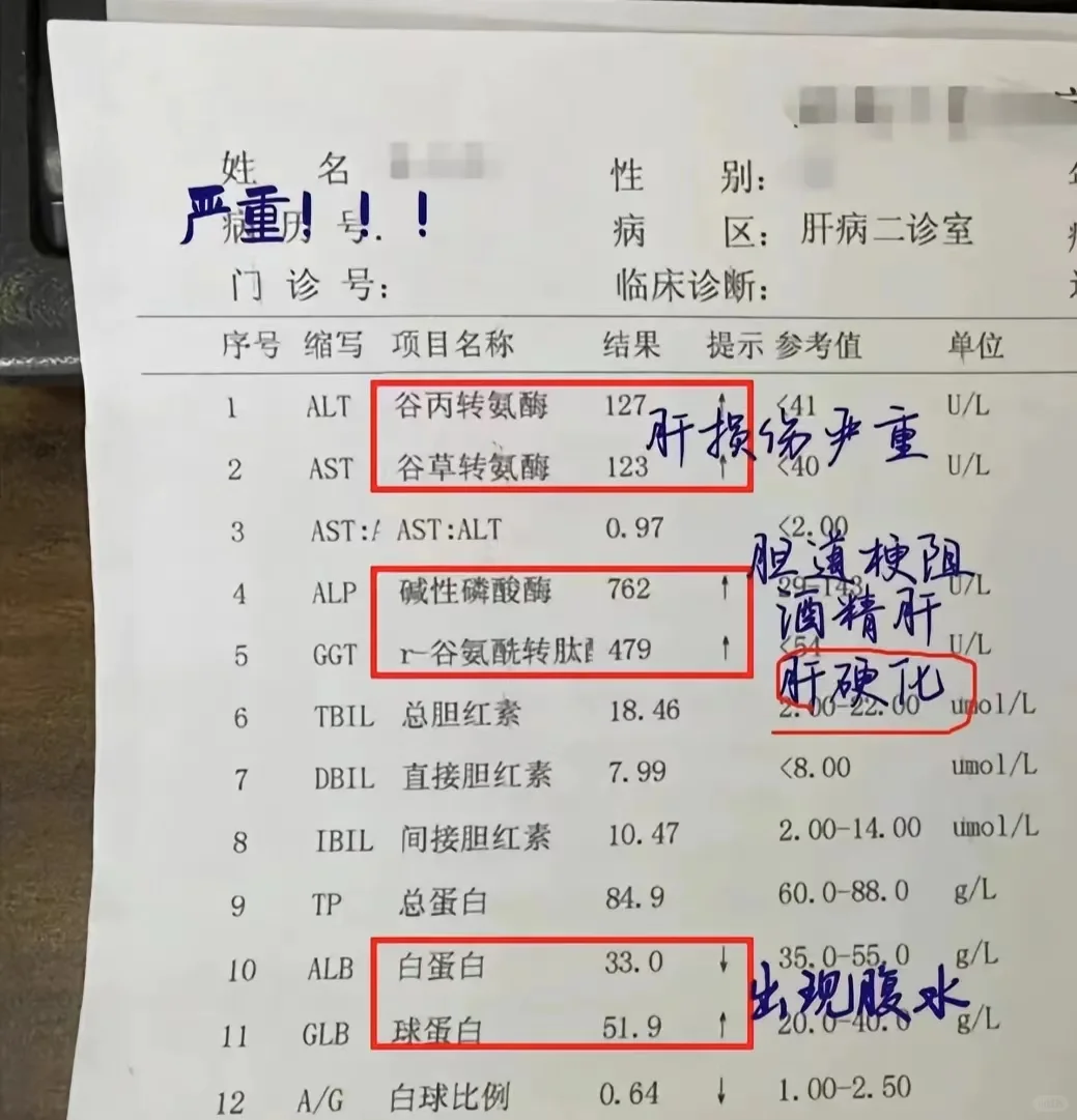 山东聊城的这位肝硬化患者病情已经很危急了