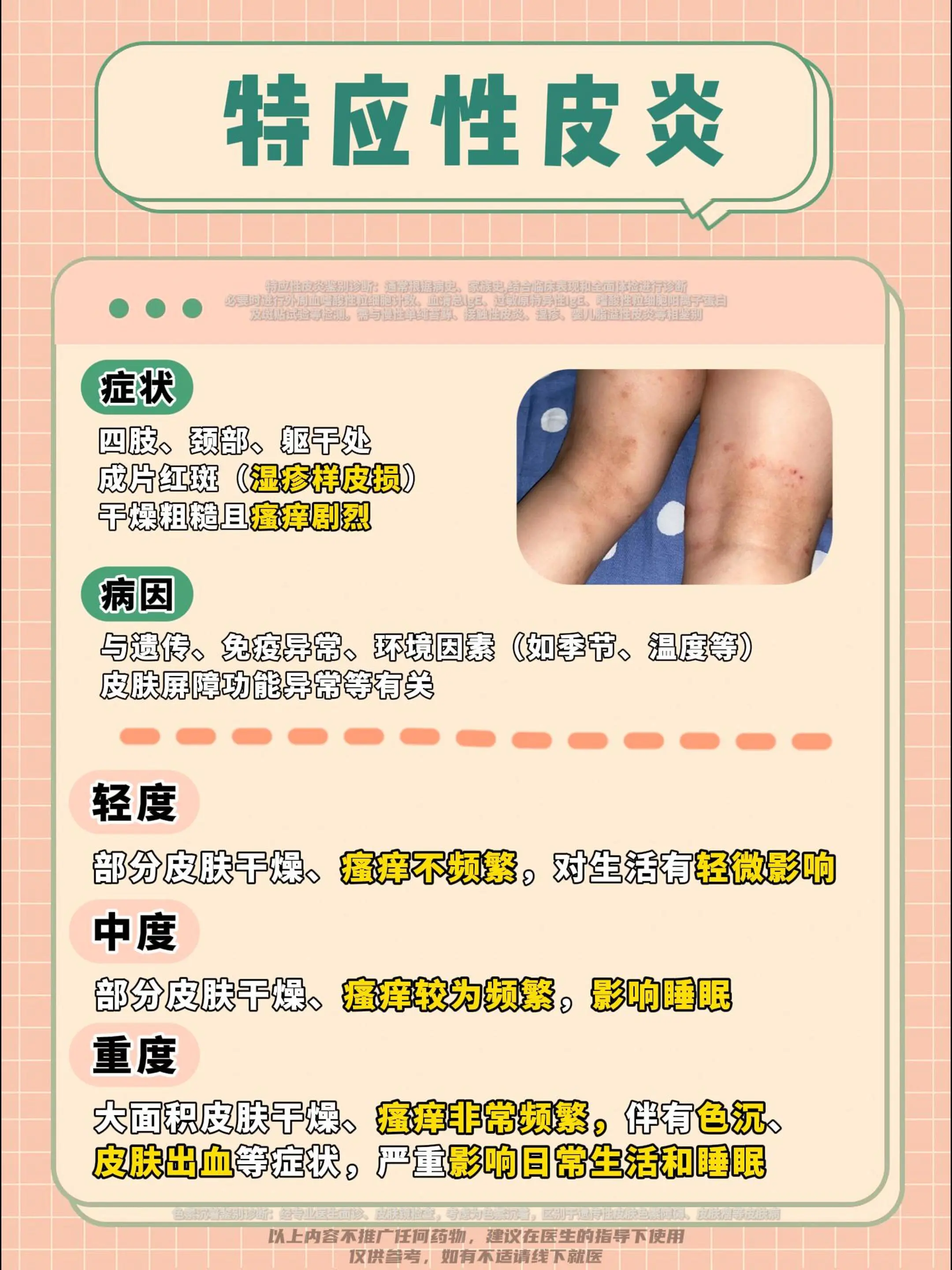 特应性皮炎不含激素外用药合集，赶紧收藏。医学科普