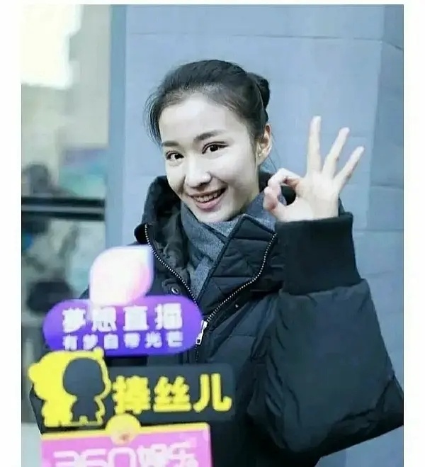 王楚然双眼皮是割的吗？ 