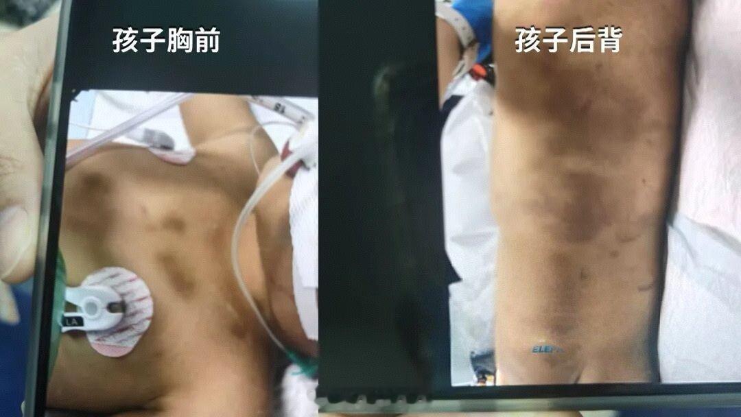 心碎！3岁男童遭生父女友虐打致死，4月21日即将宣判一个才3岁的孩子，本该被捧在