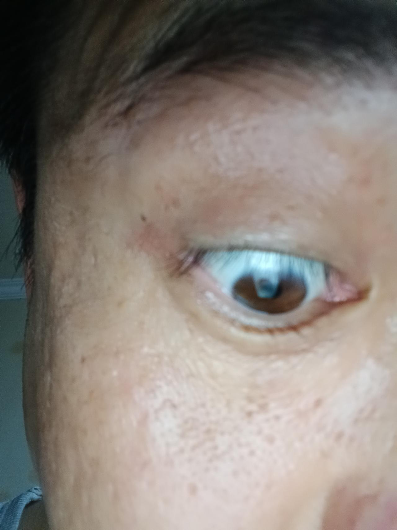 脾虚的人，眼睛永远消不掉红血丝，根源不在熬夜
 
人到中年才慢慢明白。
常年眼睛