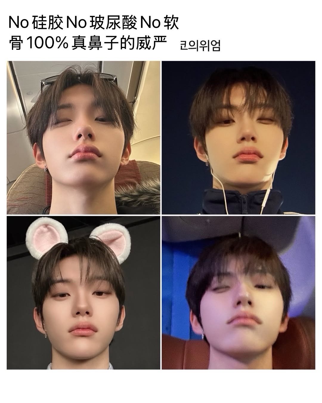 CLOSE YOUR EYES徐竟培No硅胶No玻尿酸No软骨100%真鼻子的威