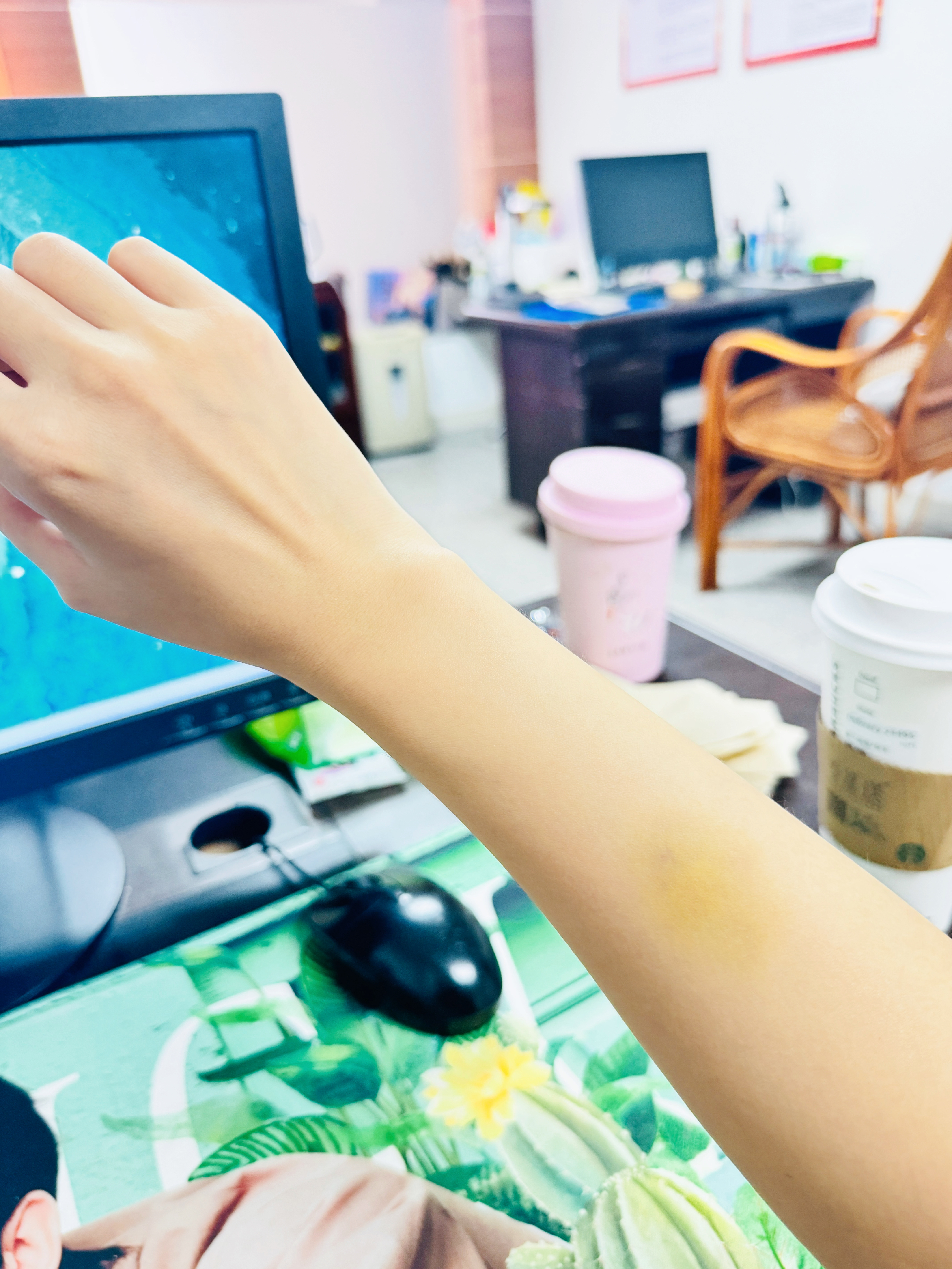 搞不懂为什么一磕碰就淤青超级严重的