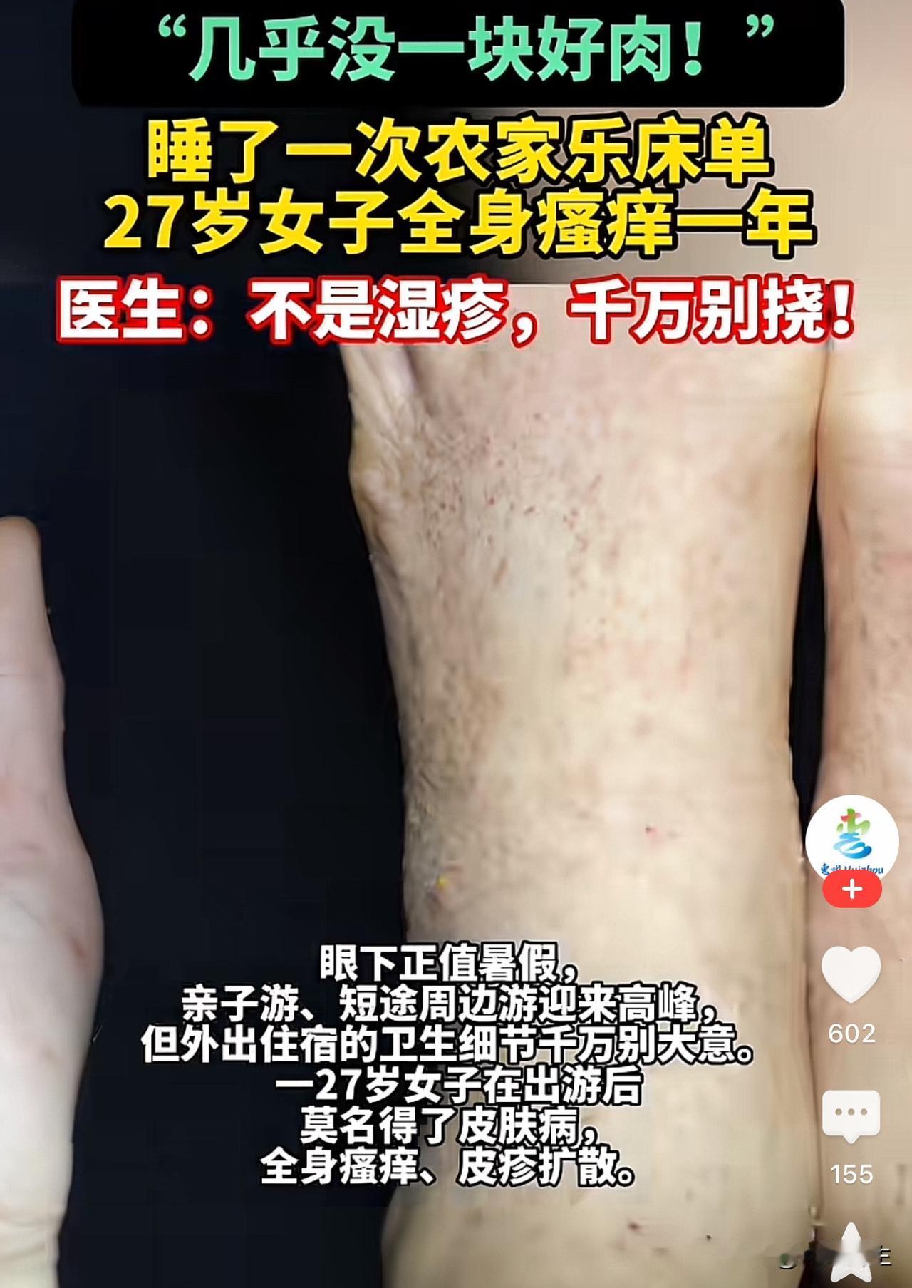 不知道大家出游最怕什么？

我最怕住酒店，不管多高级的酒店我都觉得膈应。

我总