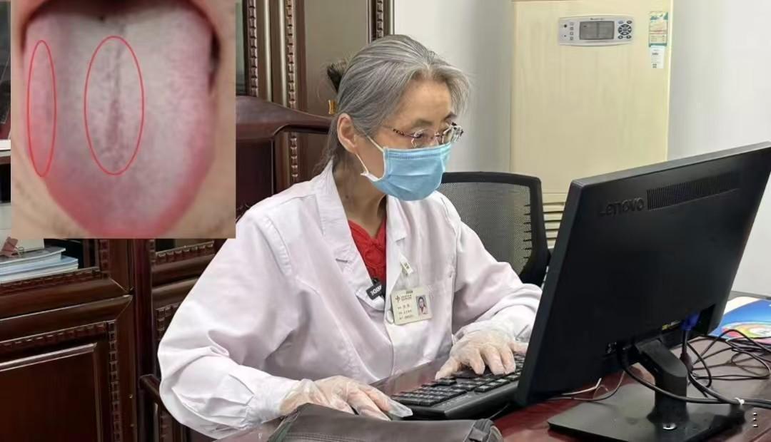 这种舌象调理起来说复杂其实也简单，就怕习惯改不掉!

患者主诉：用手较多，欲望大