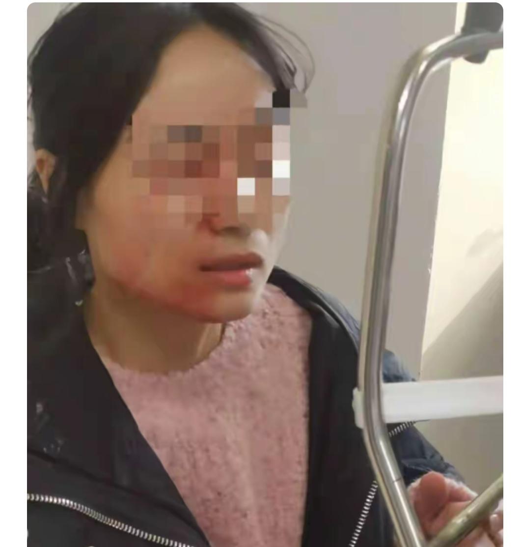 这个时代当老师真的是很困难的，这个女老师为了扯开一个6年级的男生和女同学的吵架，