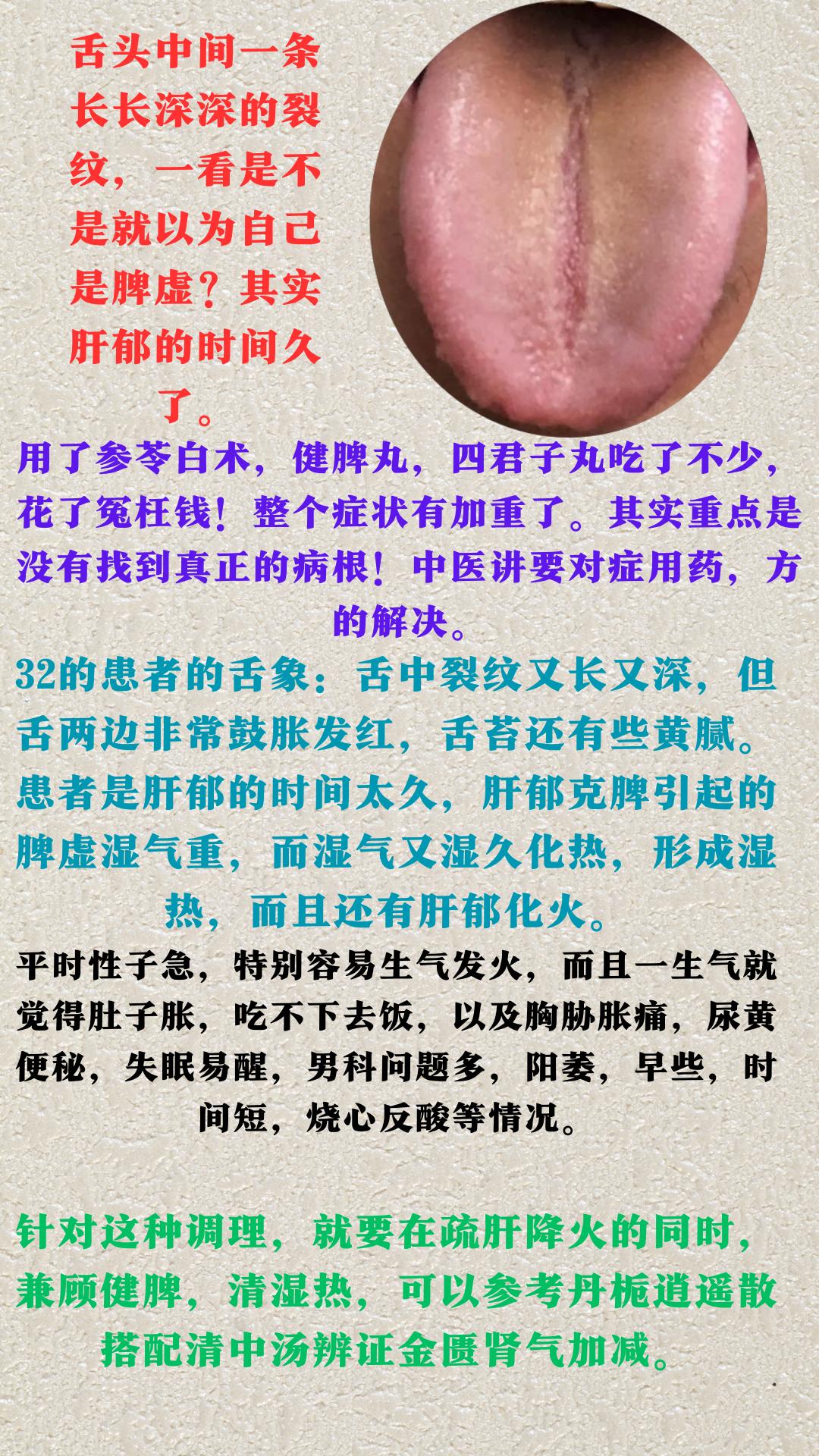 舌头中间一条长长深深的裂纹，一看是不是就以为自己是脾虚？其实肝郁、肾虚的时间久了