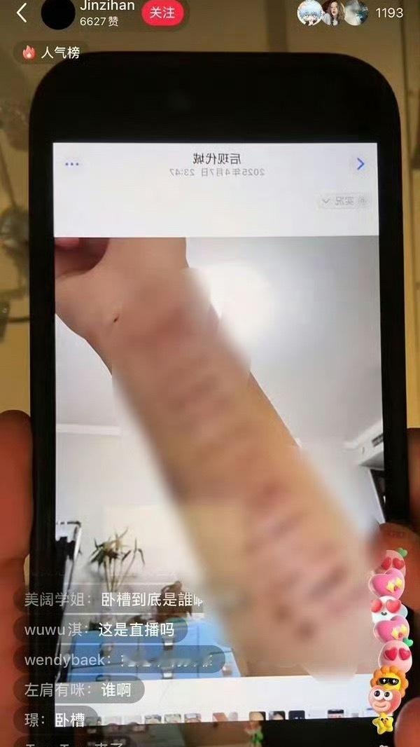 金子涵直播疑似求救 金子涵直播晒手臂照，且发长文控诉：三年前被人以“除痘消炎”为