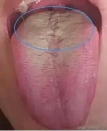 下焦潮湿功能差，看似肾虚实则暗藏玄机！2个小方子先通后补，找回身体动力
 
大家